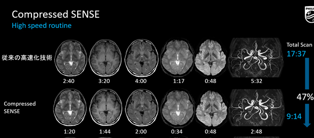 MRI